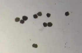 Anthrobots How Tiny Robots Made from Human Cells Are Revolutionizing Medicine