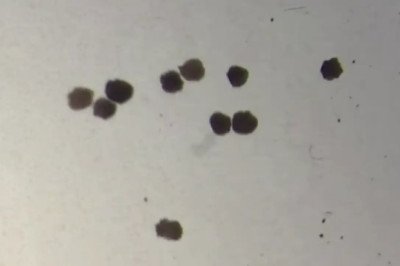 Anthrobots: How Tiny Robots Made from Human Cells Are Revolutionizing Medicine