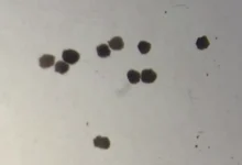 Anthrobots: How Tiny Robots Made from Human Cells Are Revolutionizing Medicine