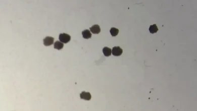 Anthrobots: How Tiny Robots Made from Human Cells Are Revolutionizing Medicine