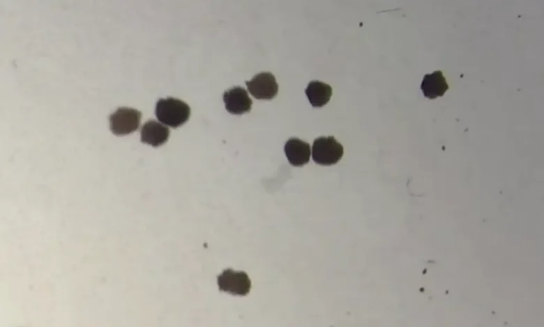 Anthrobots: How Tiny Robots Made from Human Cells Are Revolutionizing Medicine 1 Anthrobots: How Tiny Robots Made from Human Cells Are Revolutionizing Medicine