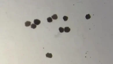 Anthrobots How Tiny Robots Made from Human Cells Are Revolutionizing Medicine